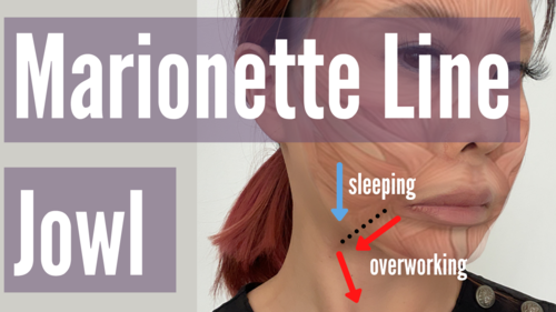 Fix Jowl Marionette Lines Koko Face Yoga