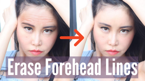 Thumbnail for a blog post titled 'Erase Forehead Wrinkles', featuring non-invasive methods and exercises to smooth out wrinkles and lines on the forehead for a youthful appearance.