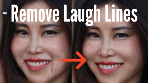 Eliminate Laugh Lines Koko Face Yoga