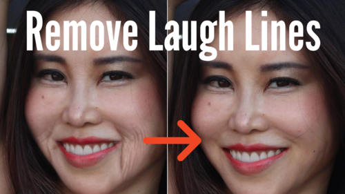 Thumbnail for a blog post titled 'Eliminate Laugh Lines', providing methods and exercises to reduce the visibility of nasolabial folds for a smoother, more youthful facial appearance.