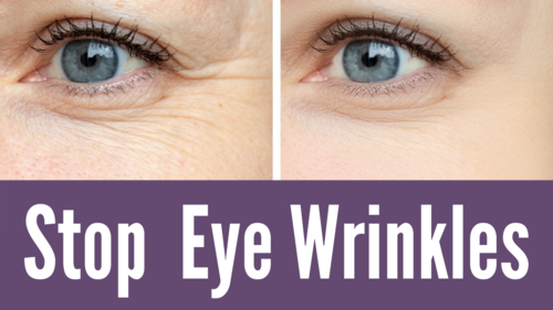 Thumbnail for 'Reduce Eye Wrinkles', showcasing techniques and treatments to diminish fine lines around the eyes for a smoother appearance.