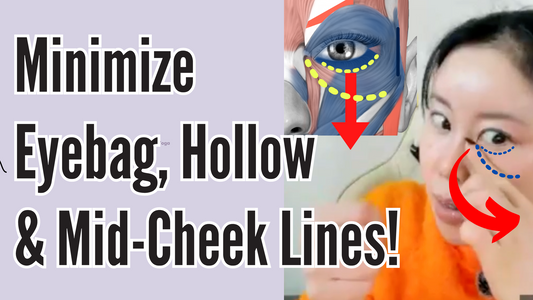 How eyebags, hollow and mid-cheek liner occur with age