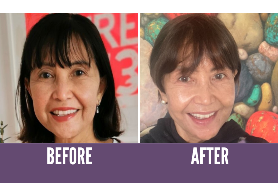 Before after
