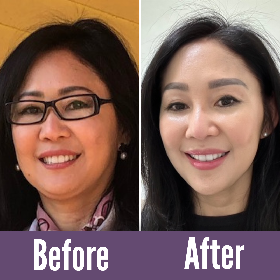 Achieve the best with Koko Face Yoga