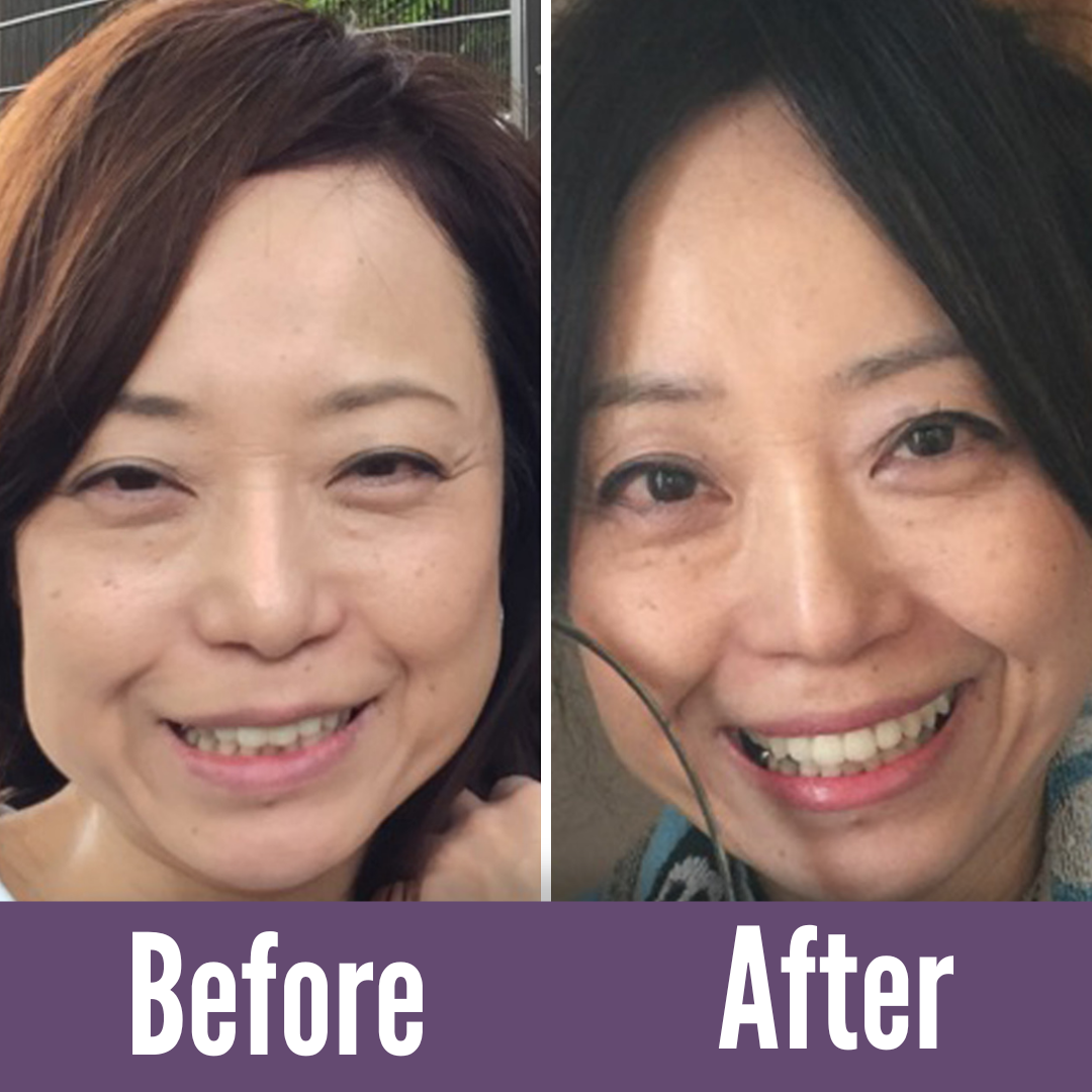 We believe our faces deserve better aging.