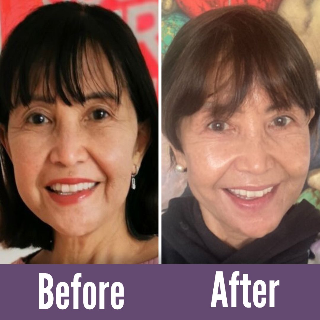 The natural solution to regain your youthful appearance.