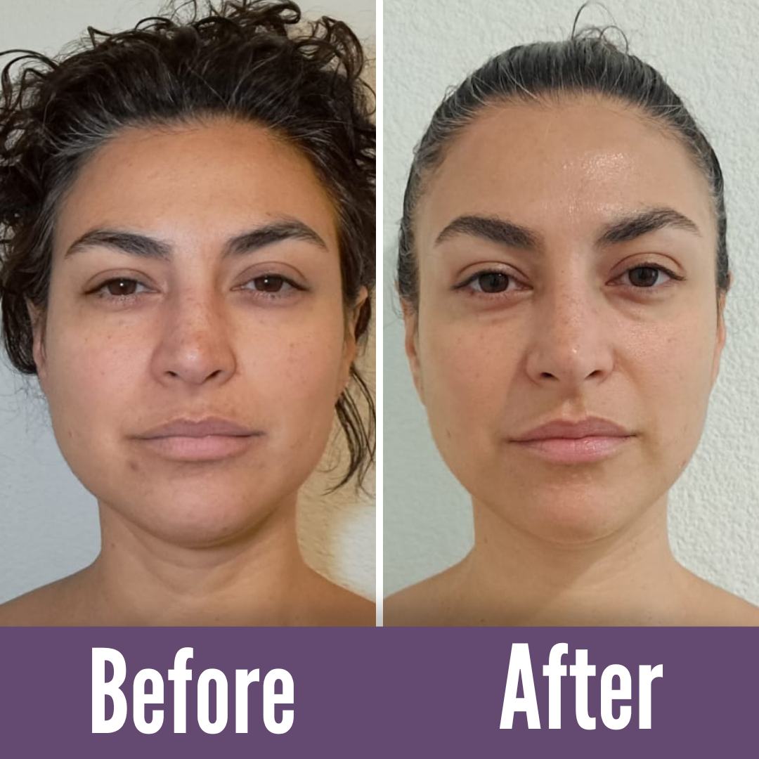 Achieve the best with Koko Face Yoga