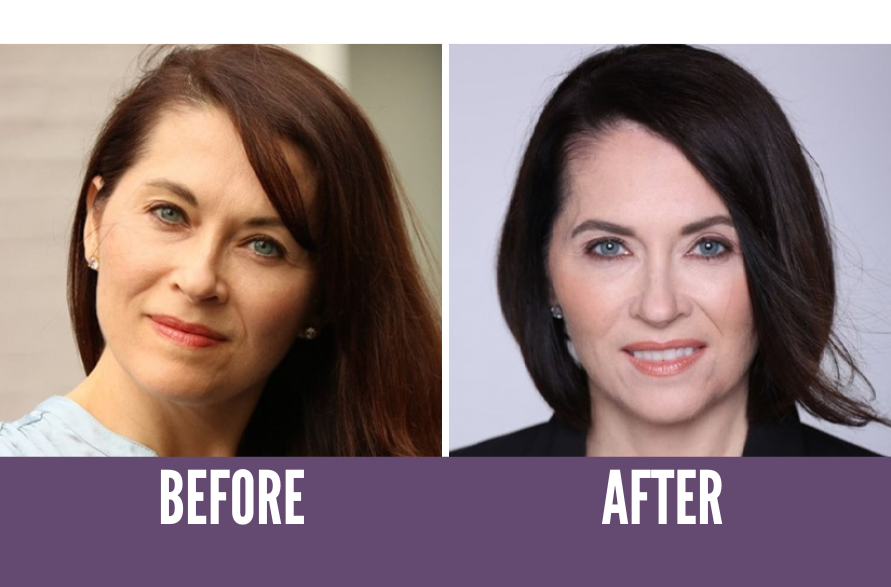 Before after