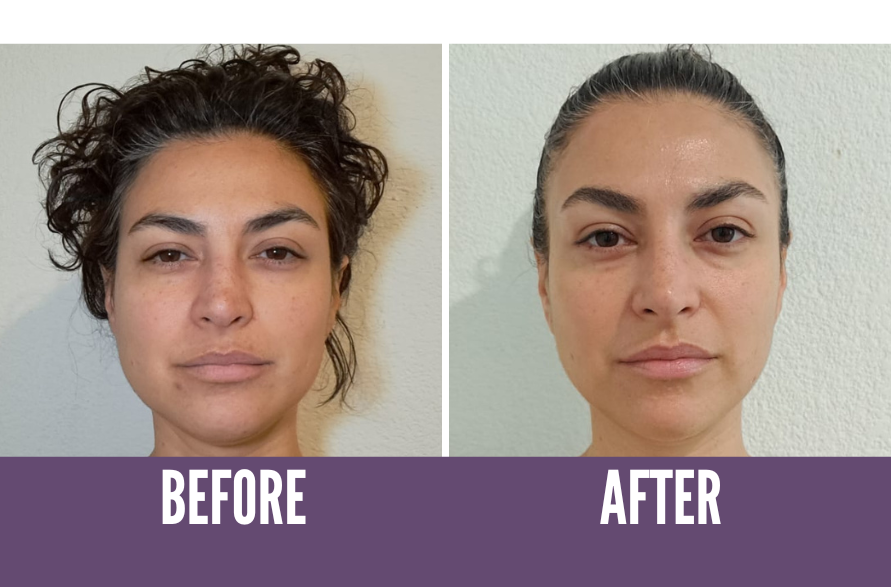 regain your youthful