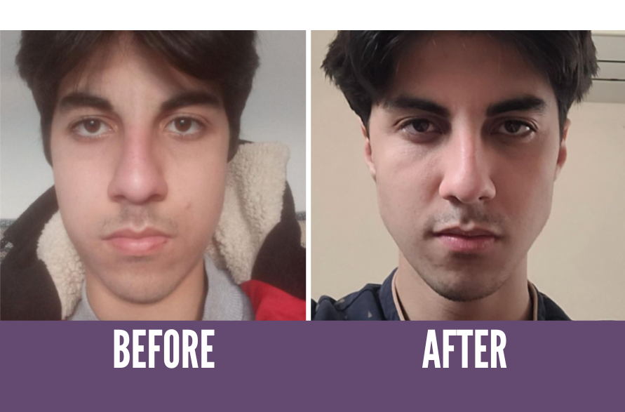 regain your youthful