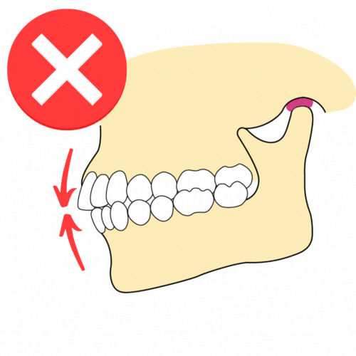 Teeth Contact