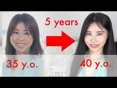 Before/After In 5 Years | How And Where Face Yoga Exercises Changed My Face