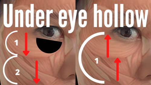Fix hollow under the eyes