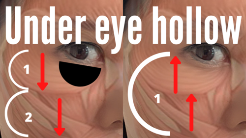 Thumbnail for 'Fix Hollow Under Eyes', with remedies and exercises to reduce under-eye hollows for a refreshed look.