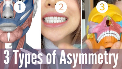 Thumbnail for a blog post titled '3 Types Of Asymmetrical Face', visually categorizing and explaining the different forms of facial asymmetry and their characteristics.