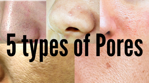 Thumbnail for '5 Types of Pores', illustrating the variety of pore types on human skin and their characteristics.