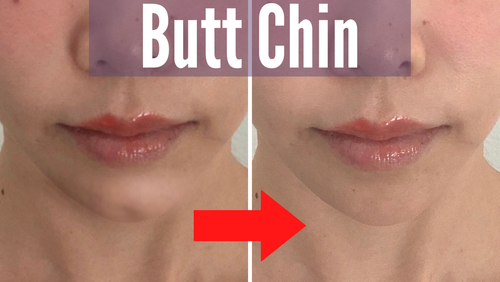 Relax Butt Chin- 3 Tips And Exercises | Koko Face Yoga