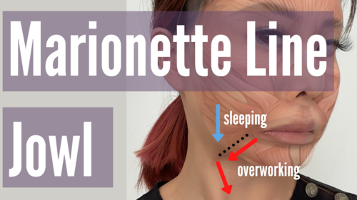 Fix Jowl & Marionette Lines