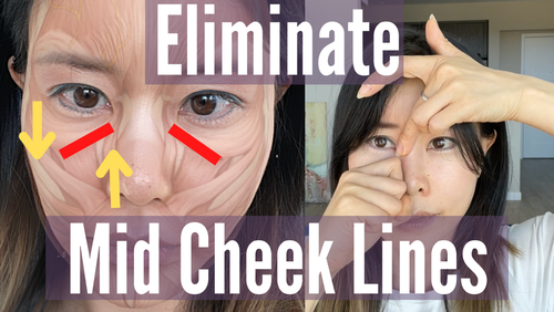 Eliminate Mid Cheek Lines