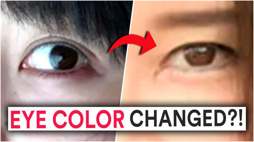 Thumbnail for 'Eye Color Changed!', showcasing the fascinating journey and methods behind changing one’s eye color naturally or through cosmetic means.