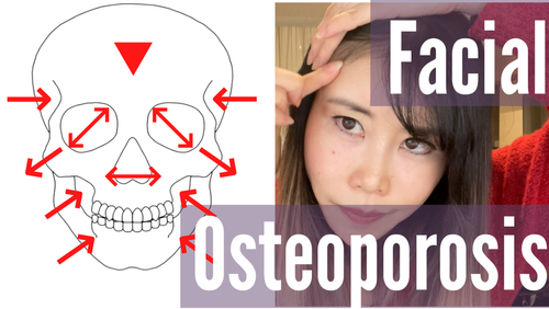 Thumbnail for a blog post titled 'Prevent Facial Osteoporosis', highlighting strategies and lifestyle choices aimed at maintaining bone density and preventing osteoporosis in the facial structure.