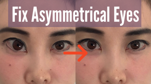 Thumbnail for a blog post titled 'Fix Asymmetrical Eyes', offering solutions and exercises to correct and balance uneven eye appearance for improved facial symmetry.