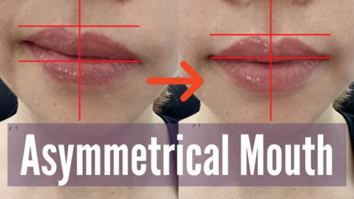Fix asymmetrical mouth and lips