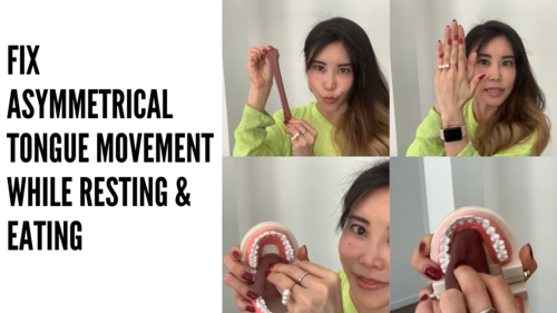 Thumbnail for 'Fix Asymmetrical Tongue Posture and Tongue Movement While Eating', showcasing exercises and tips to correct tongue alignment for improved eating habits and oral health.