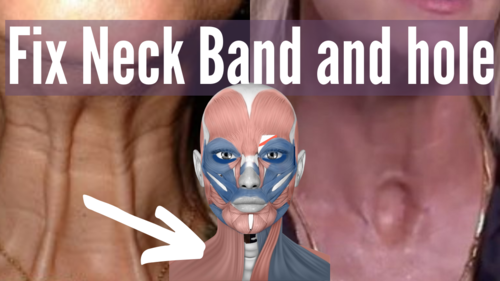 Fix Neck Band and Hole