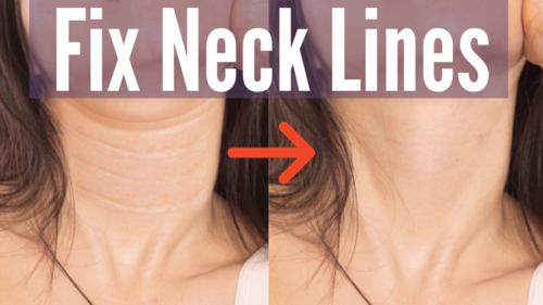 Thumbnail for a blog post titled 'Fix Neck Lines', showcasing strategies and exercises designed to diminish the appearance of horizontal lines and wrinkles on the neck