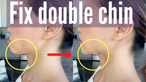 Fix double chin
