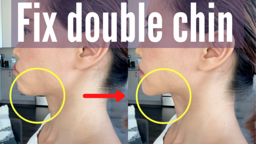 Thumbnail for a blog post titled 'Fix Double Chin', showcasing exercises and techniques designed to reduce the appearance of a double chin and enhance jawline definition.