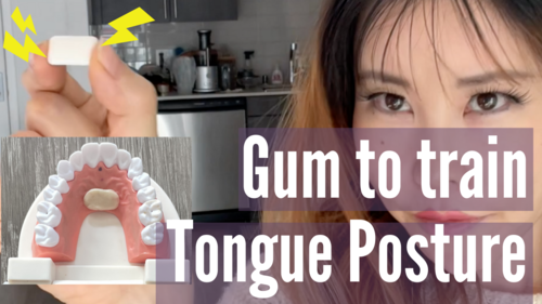 Thumbnail for 'Best Training Method For Mewing', showcasing effective techniques for practicing proper tongue posture.