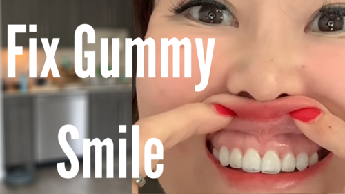 Thumbnail for 'Fix Gummy Smile', detailing exercises and techniques to reduce the visibility of gums for a more balanced smile.