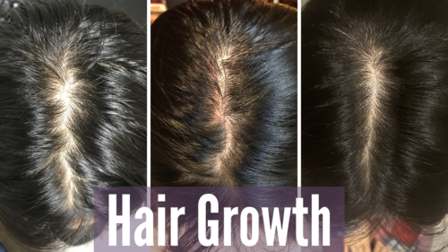 Thumbnail for 'Hair Growth Update', showcasing progress and tips for achieving longer, healthier hair.