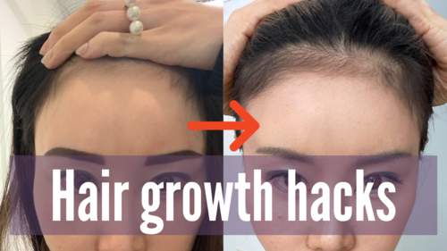10 Hair Growth Hacks