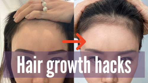 Thumbnail for a blog post titled '10 Hair Growth Hacks', featuring effective tips and natural remedies to stimulate hair growth and achieve longer, healthier hair.