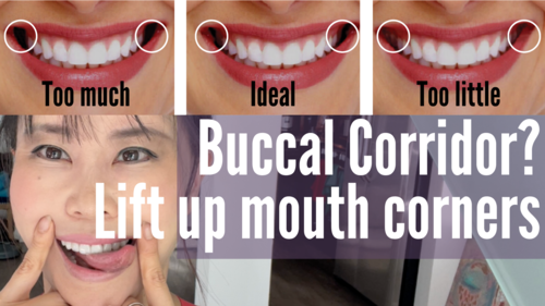 Thumbnail for 'Buccal Corridors | Smile with Lifted Corners', techniques for a brighter, more engaging smile.