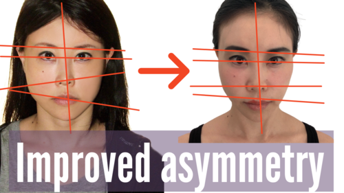 Thumbnail for a blog post titled 'Improved Facial Symmetry', showcasing the journey and techniques used to achieve a more balanced and harmonious facial appearance through exercises and lifestyle changes.