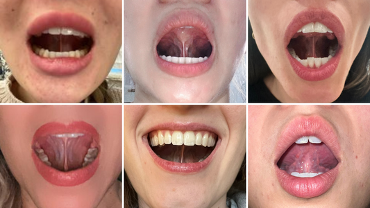 Exploring the Role of the Tongue in Facial Development