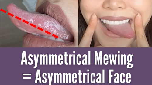Thumbnail for 'Asymmetrical Mewing Causes Asymmetrical Face,' depicting the effects of uneven mewing on facial symmetry.