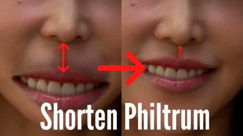Shorten Philtrum | The Latest Face Yoga By Training The Upper Lip And Skin Between Nose And Lip