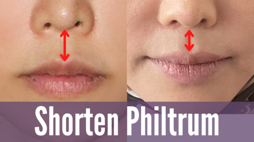 Thumbnail for a blog post titled 'Shorten Philtrum', exploring techniques and exercises designed to reduce the length of the philtrum for enhanced facial proportions and aesthetics.