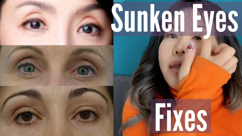 Fix Sunken Eyes