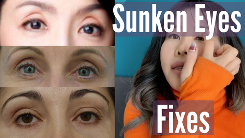 Thumbnail for 'Fix Sunken Eyes', showing strategies and remedies to address and improve the appearance of under-eye hollows and sunken eyes.