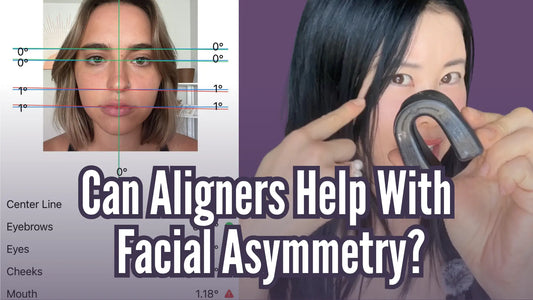 Can Aligners Help With Facial Asymmetry?