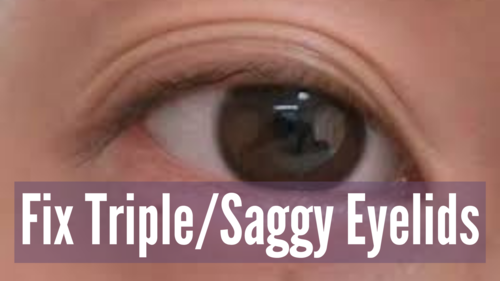 Thumbnail for 'Fix Triple Eyelids', showing methods to address and smooth out triple eyelid folds.