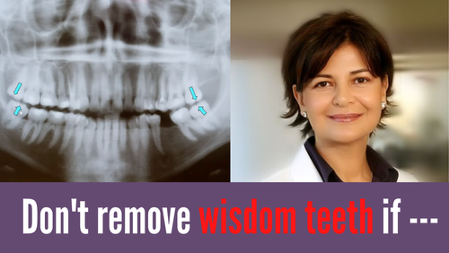 Thumbnail for 'Don't Remove Wisdom Teeth', presenting arguments and considerations against the removal of wisdom teeth, focusing on dental health and facial structure.