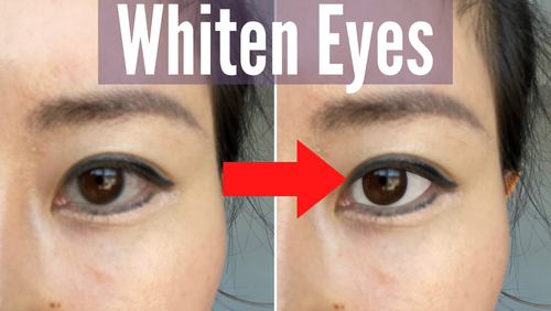Thumbnail for 'How To Whiten Eyes', featuring tips and natural remedies for enhancing the whiteness and overall health of the eyes.