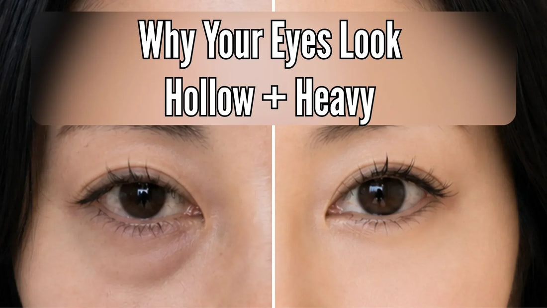 Close-up comparison of hollow, tired-looking eyes and brighter, refreshed eyes, illustrating why eyes can look hollow and heavy at the same time.